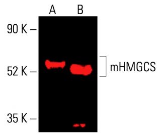 mHMGCS Antibody (B-8) | SCBT - Santa Cruz Biotechnology