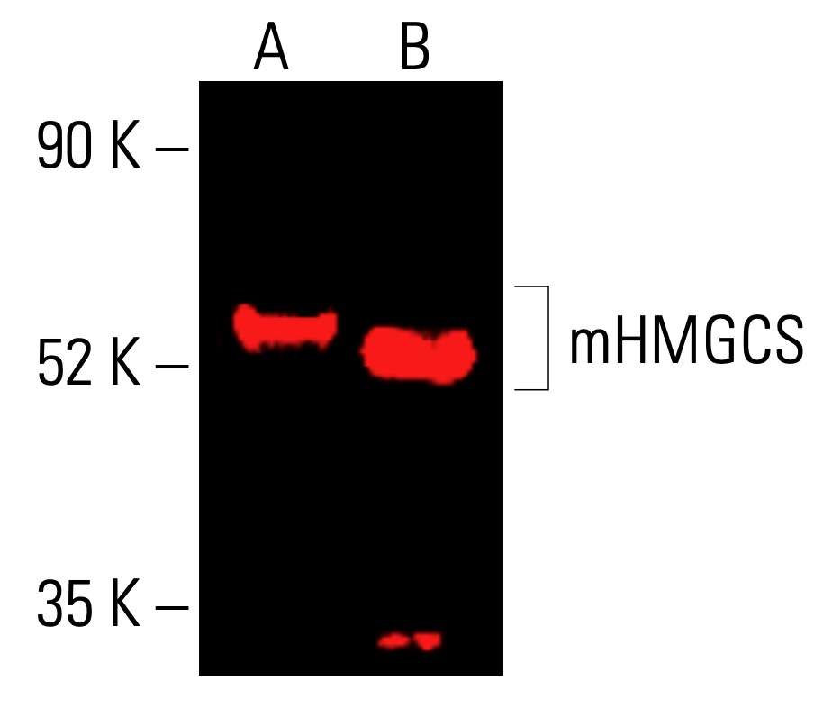 mHMGCS Antibody (B-8) | SCBT - Santa Cruz Biotechnology