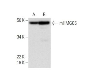 mHMGCS Antibody (G-11) - Western Blotting - Image 293094 