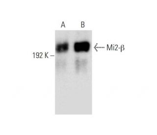 western blotting image from recommended Mi2-&beta; (F-7) monoclonal antibody replacement. Image 147404