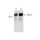 western blotting image from recommended Mi2-β (F-7) monoclonal antibody replacement. Image 147404