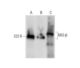 Mi2-&beta; Antibody (H-7) - Western Blotting - Image 297052 