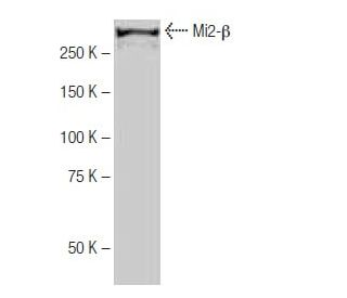 Mi2-&beta; Antibody (SW-88) - Western Blotting - Image 64998 
