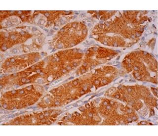 MIA Antibody (C-10) - Immunohistochemistry - Image 293426 