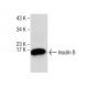 Insulin B Antibody (C-12) - Western Blotting - Image 282020