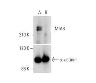 MIA3 HDR Plasmid (h): sc-403994-HDR. Western blot analysis of MIA3 expression in non-transfected control(A) and puromycin