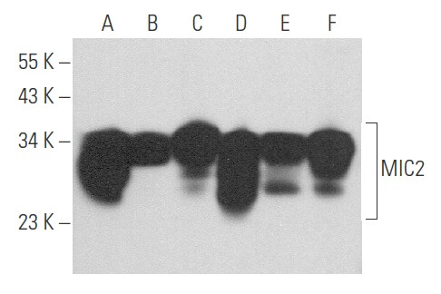 MIC2 Antikörper (12E7) | SCBT - Santa Cruz Biotechnology