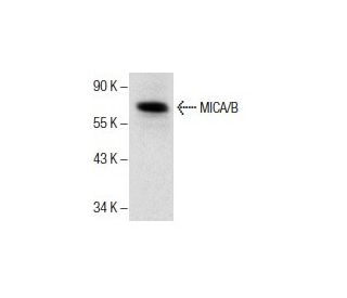 MICA/B 항체 (F-6) | SCBT - Santa Cruz Biotechnology