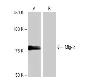 Mig-2 Antibody (NQ-A16) - Western Blotting - Image 65000