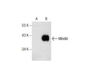 Mindin Antibody (D-4) - Western Blotting - Image 156419Each CRISPR/Cas9 Knockout (KO) Plasmid product consists of a pool of 3 plasmids designed to ensure identification and cleavage of a specific gene for maximum knockout efficiency. Each plasmid encodes a unique 20 nt sequence derived from the GeCKO (v2) library.