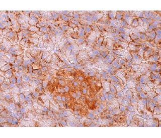 MIP-1Î+/- Antibody (M-20): sc-1383