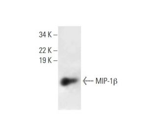 MIP-1&beta; Antibody (B-7) - Western Blotting - Image 295861 