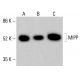 Anticorpo MIPP (A-8): sc-514214. Analisi Western blot dell'espressione di MIPP in lisati cellulari completi di HeLa (A), K-562 (B) e HCT-116 (C). Reagente di rilevamento utilizzato: m-IgG Fc BP-HRP: sc-525409. MIPP Antibody (A-8) - Western Blotting - Image 415619