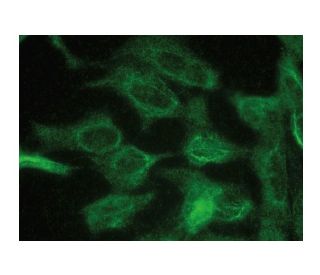 MIS Antibody (B-9) - Immunofluorescence - Image 149271 