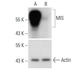 MIS siRNA h shRNA and Lentiviral Particle Gene Silencers SCBT