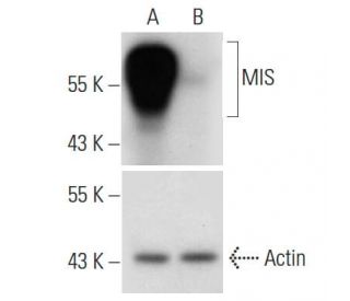 MIS shRNA Plasmid (h): sc-39793-SH. Western blot analysis of human MIS expression in MIS transfected (A) and MIS/MIS shRNA 