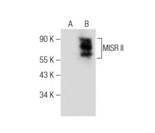 MISR II Antibody (D-9) - Western Blotting - Image 284483Each CRISPR/Cas9 Knockout (KO) Plasmid product consists of a pool of 3 plasmids designed to ensure identification and cleavage of a specific gene for maximum knockout efficiency. Each plasmid encodes a unique 20 nt sequence derived from the GeCKO (v2) library. 