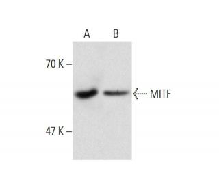 MITF Antibody (21D1418) - Western Blotting - Image 143377