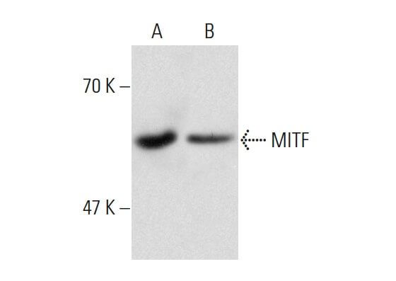 MITF Antibody (21D1418) | SCBT - Santa Cruz Biotechnology
