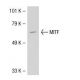 MITF Antibody (4H205) - Western Blotting - Image 38612