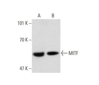 MITF Antibody (4H205) - Western Blotting - Image 143379 