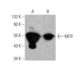 western blotting image from recommended MITF (D-9) monoclonal antibody replacement. Image 378353