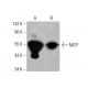 Este anticorpo policlonal foi descontinuado. Consulta o nosso anticorpo monoclonal <a href="mitf-antibody-d-9">MITF (D-9)</a> recomendado (dados de amostra apresentados). western blotting image from recommended MITF (D-9) monoclonal antibody replacement. Image 378353