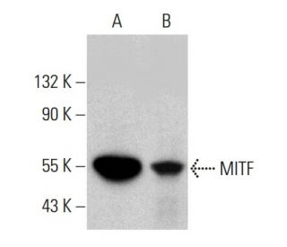 みFD MITF Antibody (D-9) | SCBT - Santa Cruz Biotechnology
