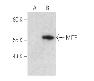 MITF Antibody (D-9) - Western Blotting - Image 389900