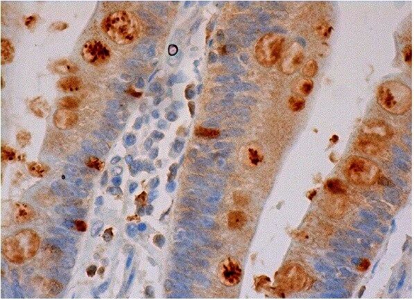MK Antibody (A-9) | SCBT - Santa Cruz Biotechnology