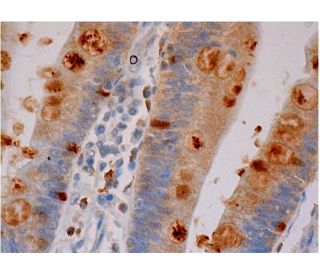 immunohistochemistry image from recommended MK (A-9) monoclonal antibody replacement. Image 286344
