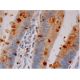 immunohistochemistry image from recommended MK (A-9) monoclonal antibody replacement. Image 286344
