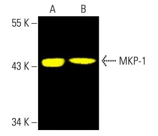 MKP-1/DUSP1 Antibody (E-6) - Western Blotting - Image 403336SAM Transcription Activation: SAM system utilizing dCas9-VP64, MS2-P65-HSF1, and sgRNA for precise gene transcription activation.