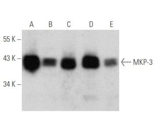 western blotting image from recommended MKP-3 (F-12) monoclonal antibody replacement. Image 354782