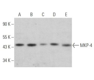 MKP-4 Antibody (D-3) - Western Blotting - Image 360668Each CRISPR/Cas9 Knockout (KO) Plasmid product consists of a pool of 3 plasmids designed to ensure identification and cleavage of a specific gene for maximum knockout efficiency. Each plasmid encodes a unique 20 nt sequence derived from the GeCKO (v2) library. 