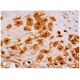 ML-IAP Antibody (E-3) - Immunohistochemistry - Image 333301 