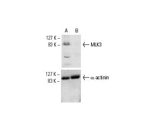 MLK3 siRNA (m): sc-35946. Western blot analysis of MLK3 expression in non-transfected control (A) and MLK3 transfected (B) 