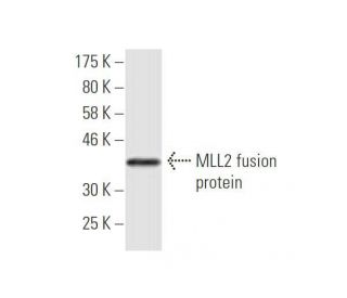 MLL2 Antibody (2E1) - Western Blotting - Image 348891