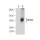 MLN64 Antibody (B-2) - Western Blotting - Image 285390 