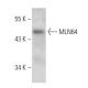 MLN64 Antibody (B-2) - Western Blotting - Image 389122