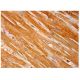 MLN64 Antibody (G-3) - Immunohistochemistry - Image 293706 