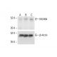 MLN64 Antibody (G-3) - Western Blotting - Image 412144