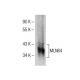 MLN64 Antibody (H-1) - Western Blotting - Image 285392