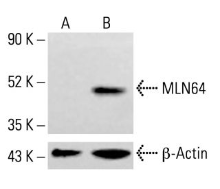 MLN64 Antibody (H-1) - Western Blotting - Image 413733Each CRISPR/Cas9 Knockout (KO) Plasmid product consists of a pool of 3 plasmids designed to ensure identification and cleavage of a specific gene for maximum knockout efficiency. Each plasmid encodes a unique 20 nt sequence derived from the GeCKO (v2) library.