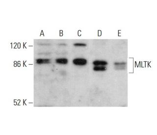 MLTK Antibody (A-2) - Western Blotting - Image 379880 