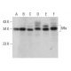 western blotting image from recommended Mlx (F-12) monoclonal antibody replacement. Image 382771