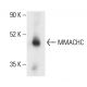 MMACHC Antibody (B-5) - Western Blotting - Image 404064 