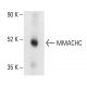 MMACHC Antibody (B-5) - Western Blotting - Image 404065 