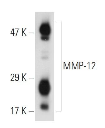 MMP-12 Antibody (A-2) | SCBT - Santa Cruz Biotechnology