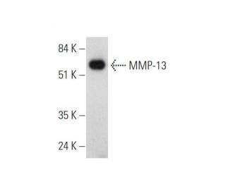 MMP-13 Antibody (C-3) - Western Blotting - Image 344700The Double Nickase Plasmid features a U6 promoter for sgRNA expression, a 20 nt targeting sequence, and a gRNA scaffold to guide Cas9n. It includes a CBh promoter for Cas9n (D10A) and puromycin resistance, GFP for transfection verification, and nuclear localization signals (NLS). The 2A peptide allows co-expression of Cas9n and Puro from a single promoter, enabling precise genome editing with reduced off-target effects. 